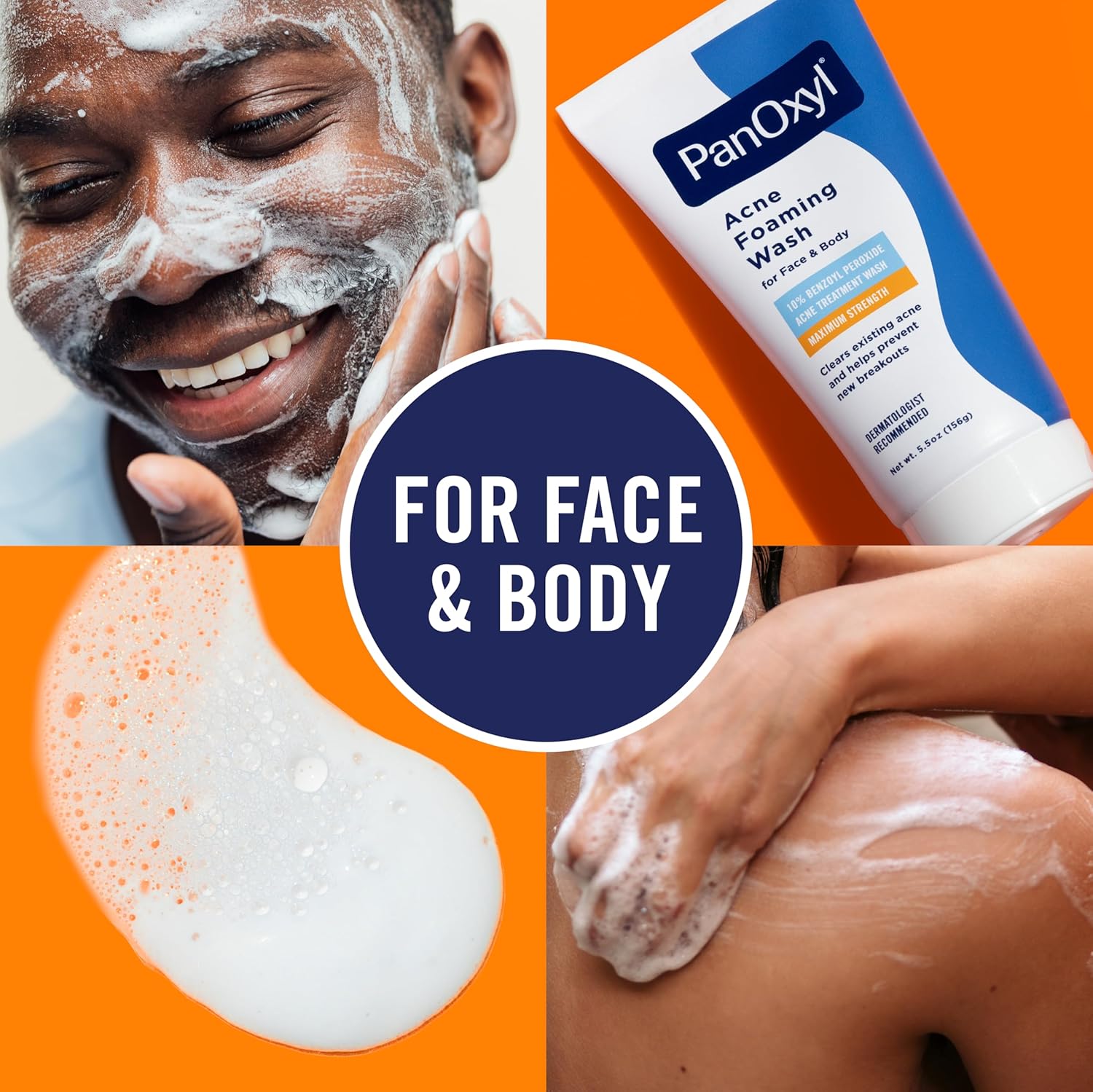 Deep-Cleansing Face Wash with 10% Benzoyl Peroxide